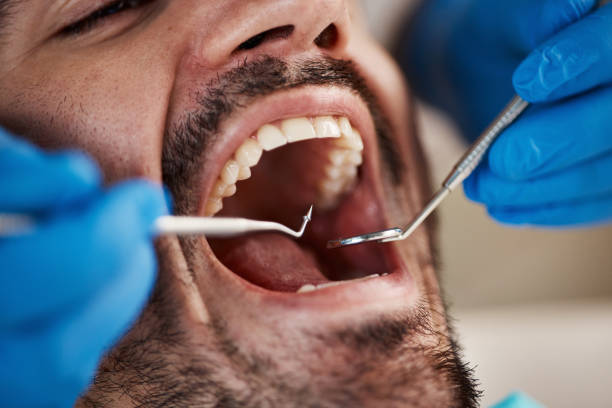 Best Emergency Dental Care for Broken or Chipped Teeth in Estill, SC